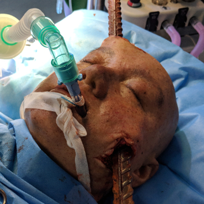 Holby City Patient Head Operation